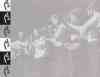 inline